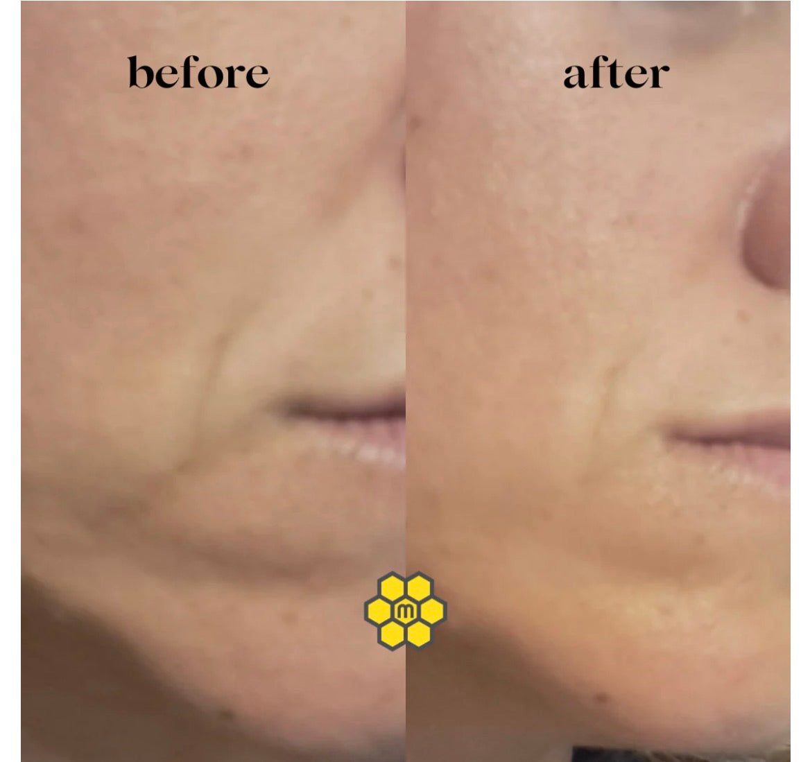 Propolis Oleoserum - Well-aging serum